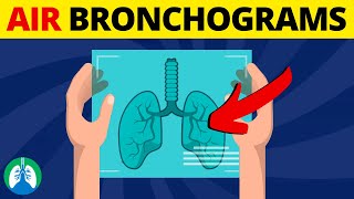 Air Bronchogram Medical Definition  Quick Overview [upl. by Llebasi]