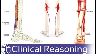 Achilles Tendinopathy Differential Diagnosis [upl. by Aik]