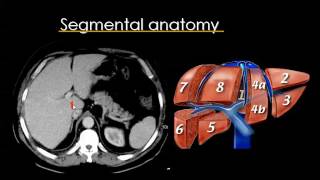 CT Liver Prof Dr Mamdouh Mahfouz [upl. by Benita]