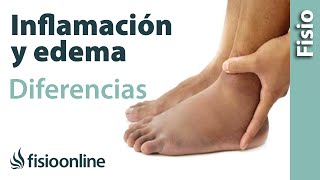 Inflamación y edema  Diferencias y características [upl. by Ellehcar942]