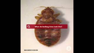 Identifying Bed Bug Bites What You Need to Know [upl. by Tullius]