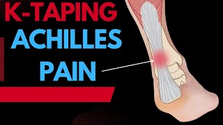 How to treat Achilles Tendonitis using Kinesiology tape [upl. by Garey]