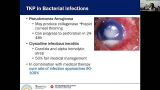 Penetrating Keratoplasty in Infectious Keratitis [upl. by Debora]