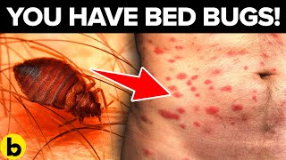 Rash Or Bite Warning Signs You May Have Bed Bugs [upl. by Silverts323]