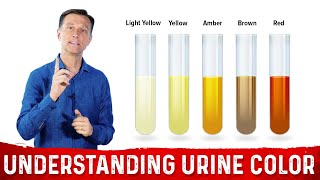 What Urine Color Indicates About Your Body – DrBerg [upl. by Deonne]